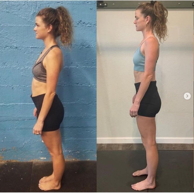 Confronto posturale prima e dopo Functional Patterns