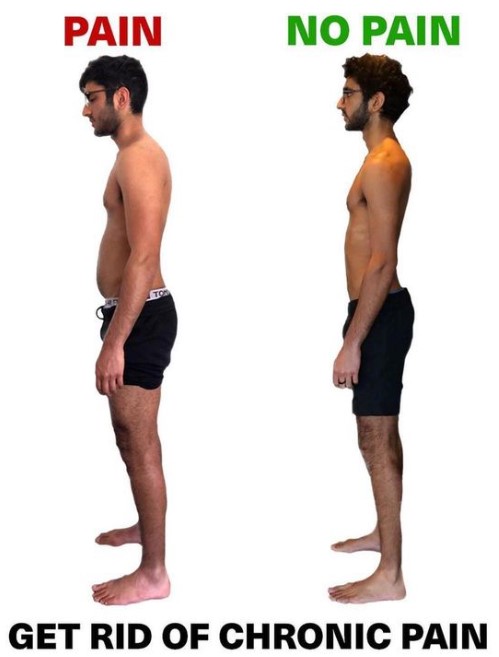 Miglioramento della postura con Functional Patterns