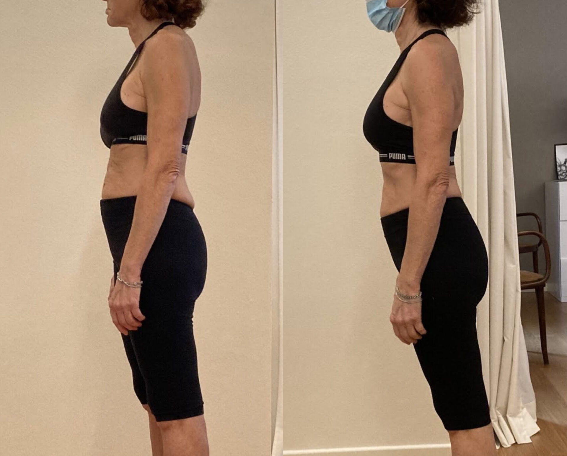 Miglioramento della qualità della vita